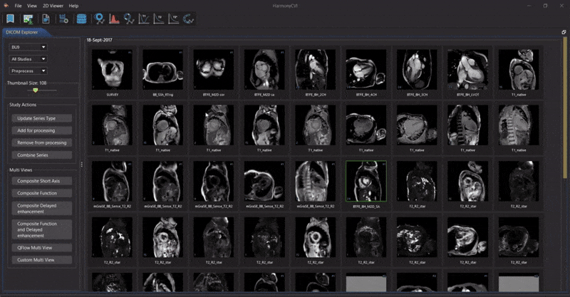 AI_Speed